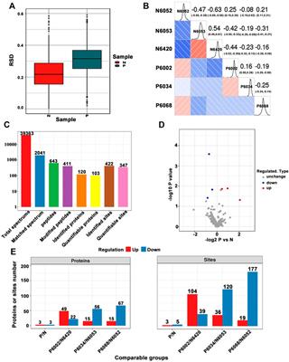 Proteomic Analysis of Serum Lysine Acetylation in Uyghur Patients With T2DM